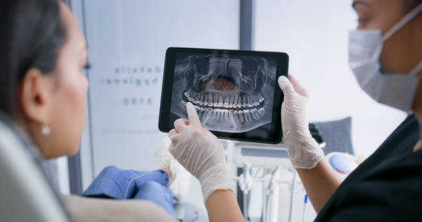 Licensed Tooth Extraction service in Crawfordsville, IN - Smile Center Dentistry